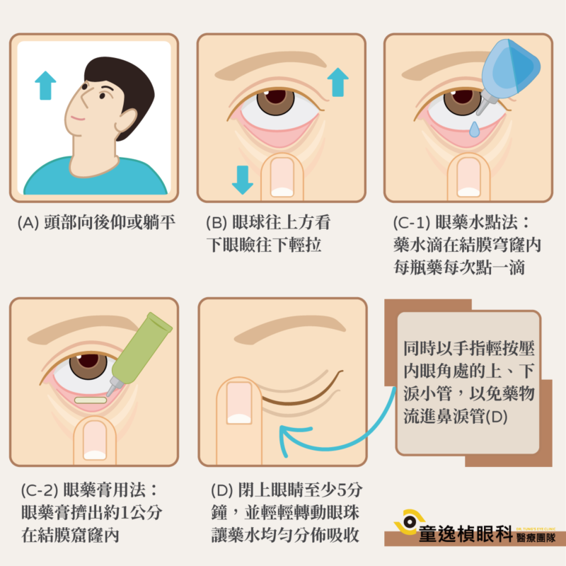 眼藥水&眼藥膏用法4步驟